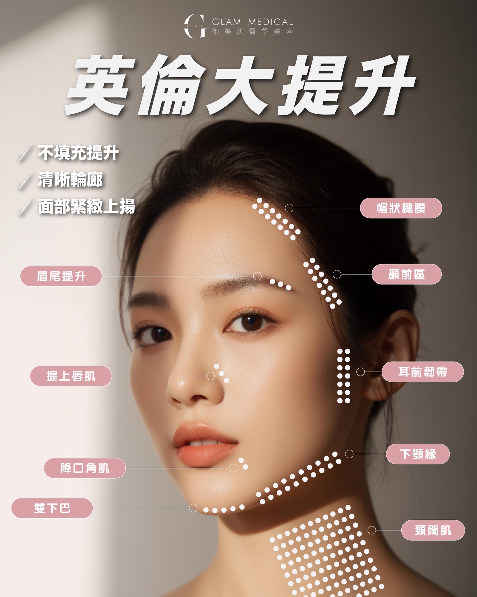英倫大提升 · 八大提升位置圖